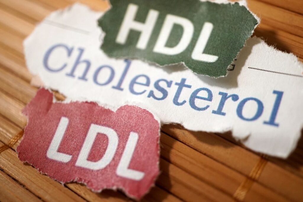 Cholesterol