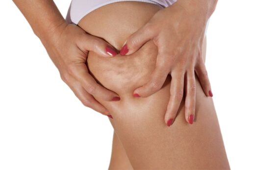 Combattre Cellulite Cbd